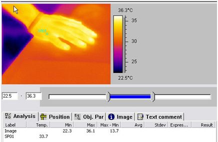 Thermographic data